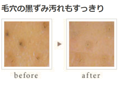 Exfoliater | メニュー対応機器 | 製品情報 | タカラベルモント